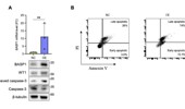 BASP1 is a potential relapse-associated diagnostic marker for adult patients with B-cell acute lymphoblastic leukemia